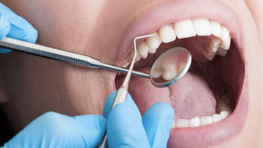 DENTAL CLEANING
