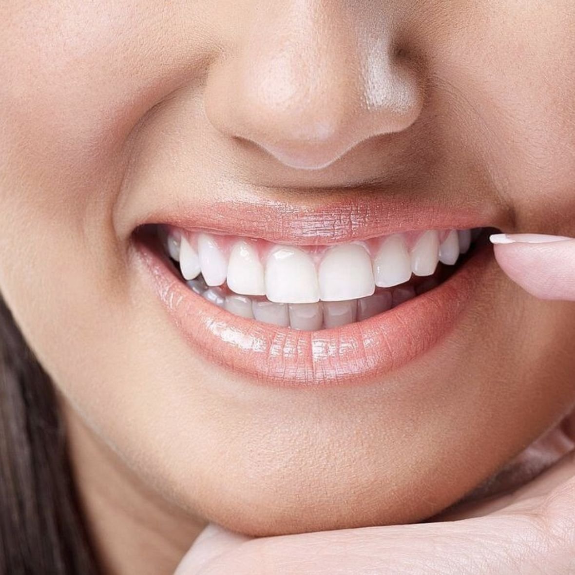 teeth whitening